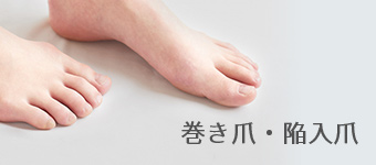 巻き爪・陥入爪